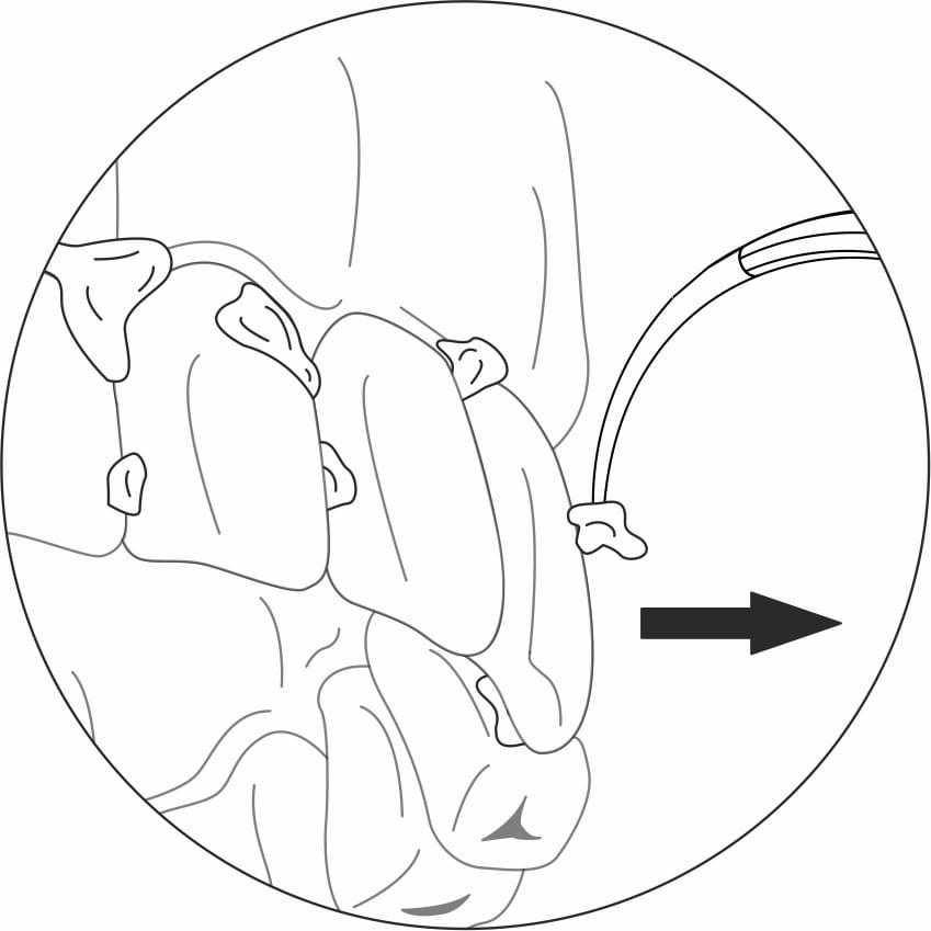 User-Friendly Approach