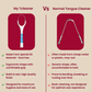 MyTCleaner (Tongue Cleaner)